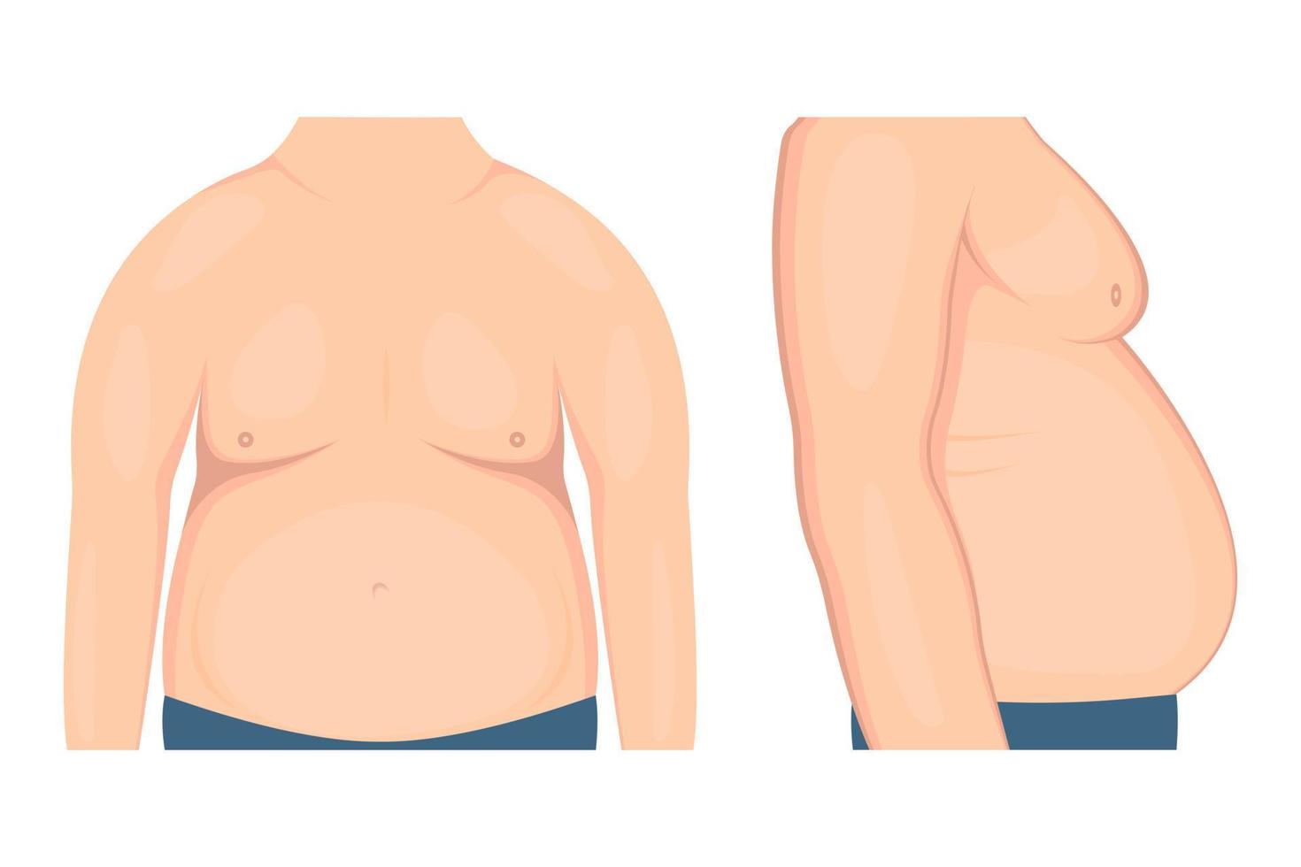 Vector illustration of slimming genetic problems. Human body obesity with weight loss disorders..