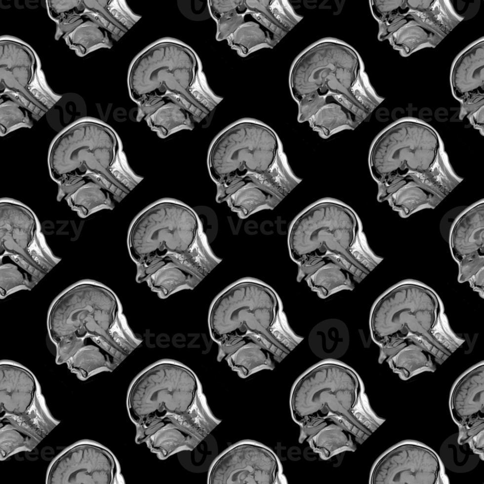 seamless pattern of sagittal MRI scans of sixty years old caucasian female head on black background photo