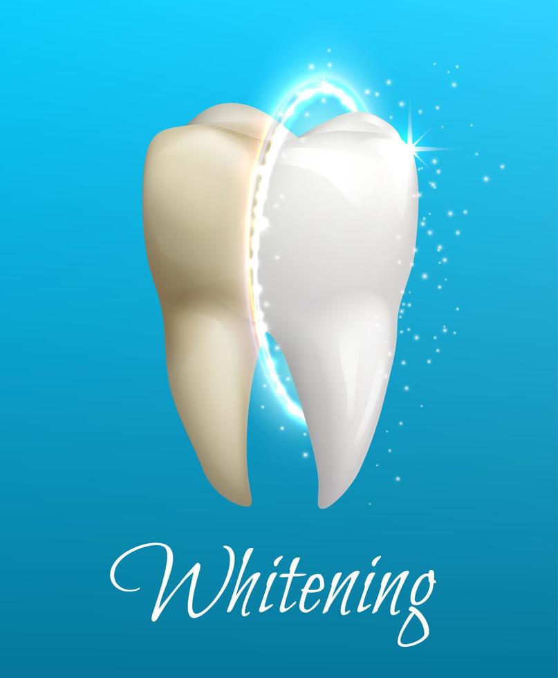 Teeth whitening concept with clean and dirty tooth vector