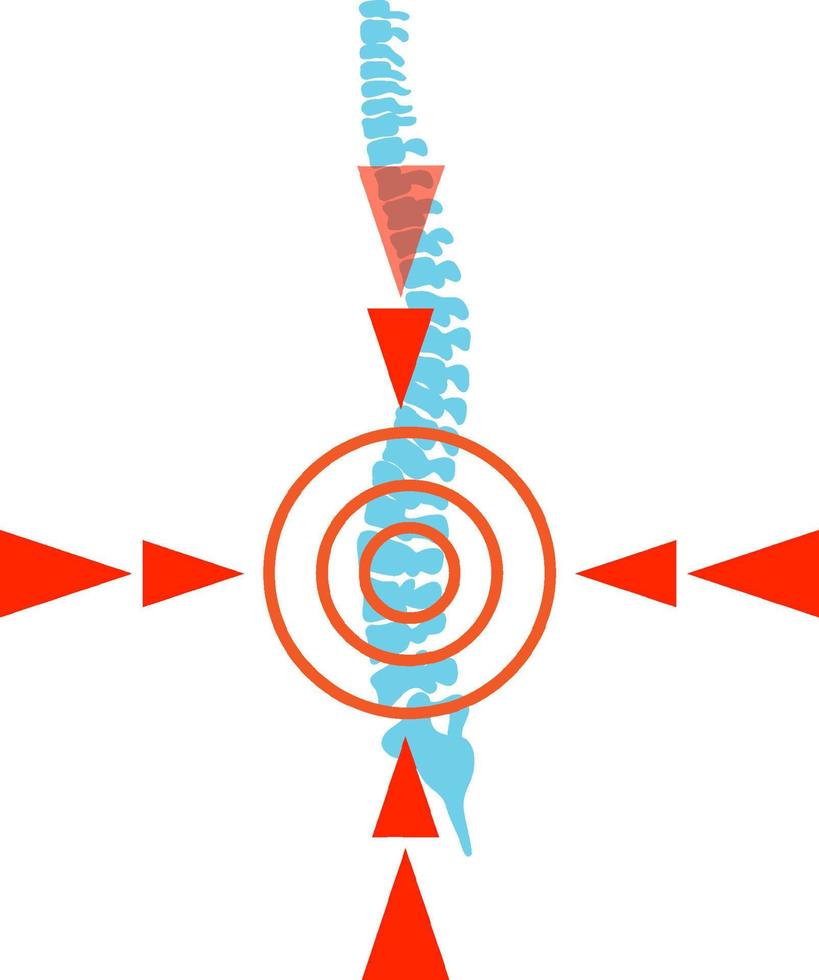 Red spot on spine vector