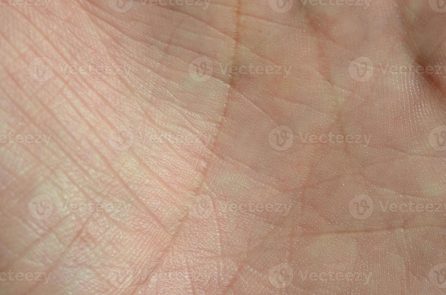 Close up of human hand skin with visible skin texture and lines photo