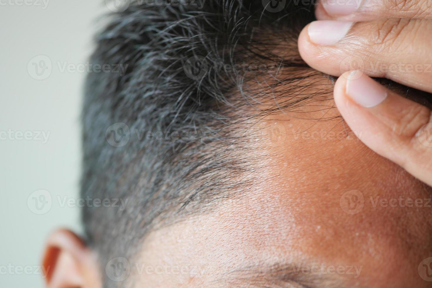 concepto de pérdida de cabello con el hombre revisando su cabello foto