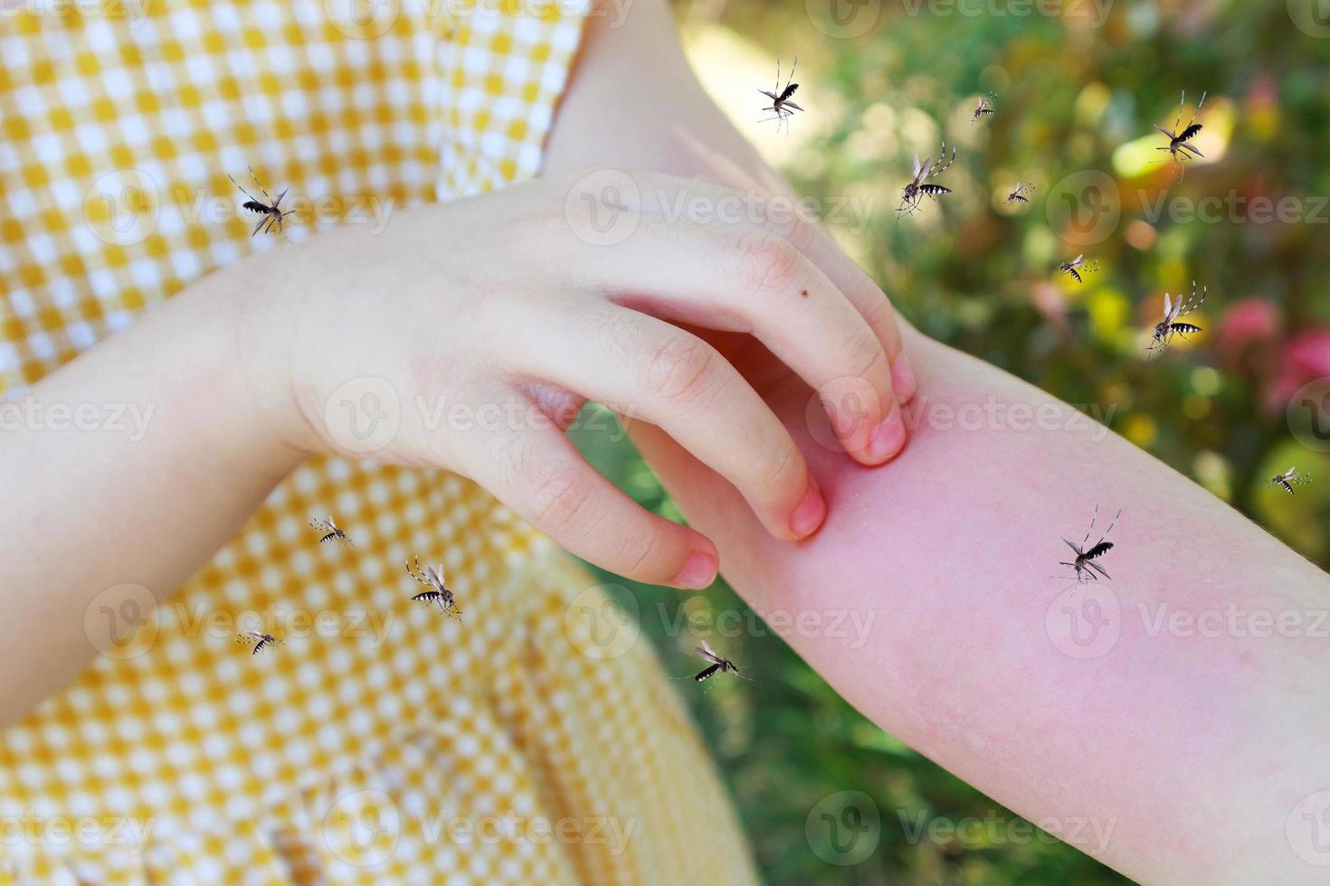 Little girl has skin rash allergy and itchy on her arm from mosquito bite photo