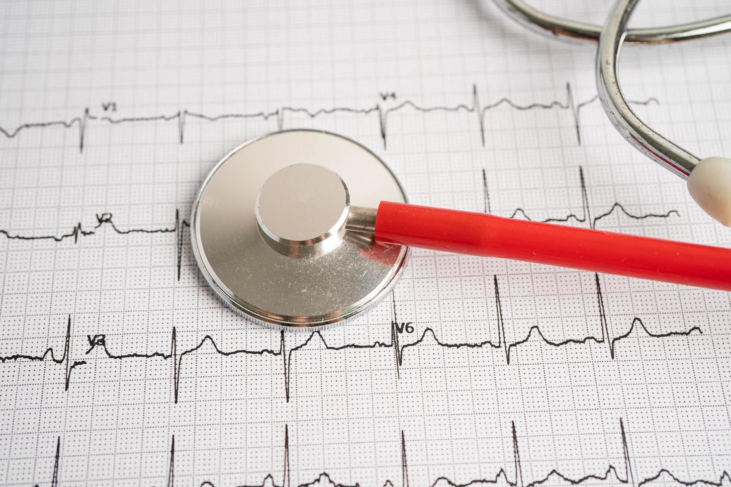 Stethoscope on electrocardiogram ECG, heart wave, heart attack, cardiogram report. photo