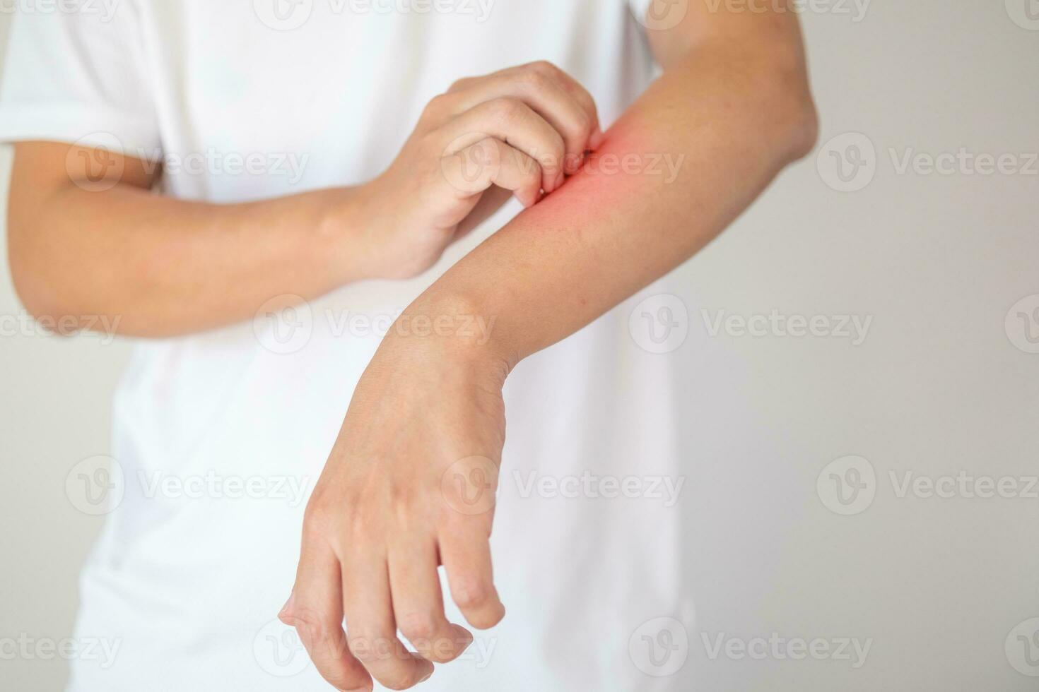 man itching and scratching on arm from itchy dry skin eczema dermatitis photo