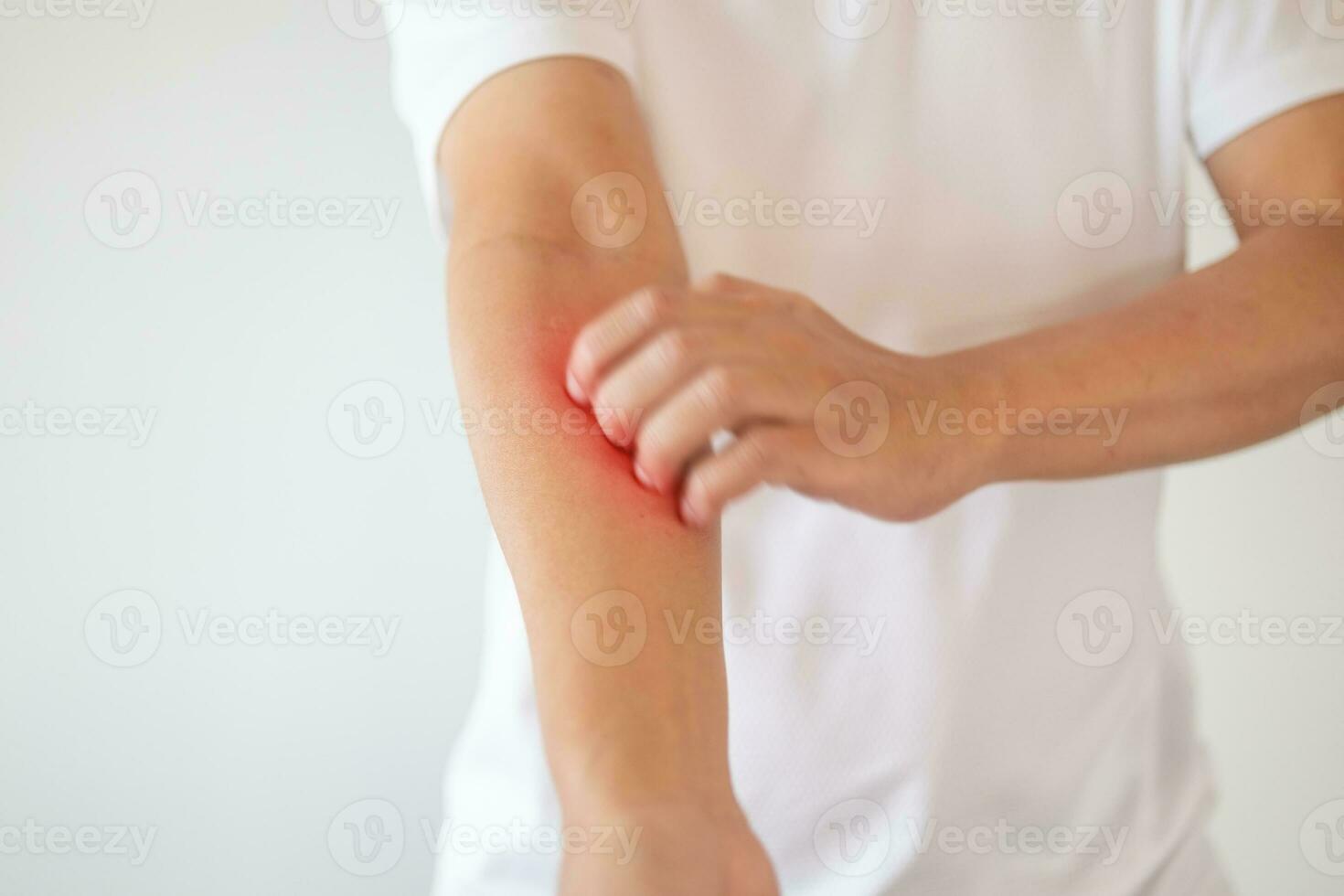 man itching and scratching on arm from itchy dry skin eczema dermatitis photo
