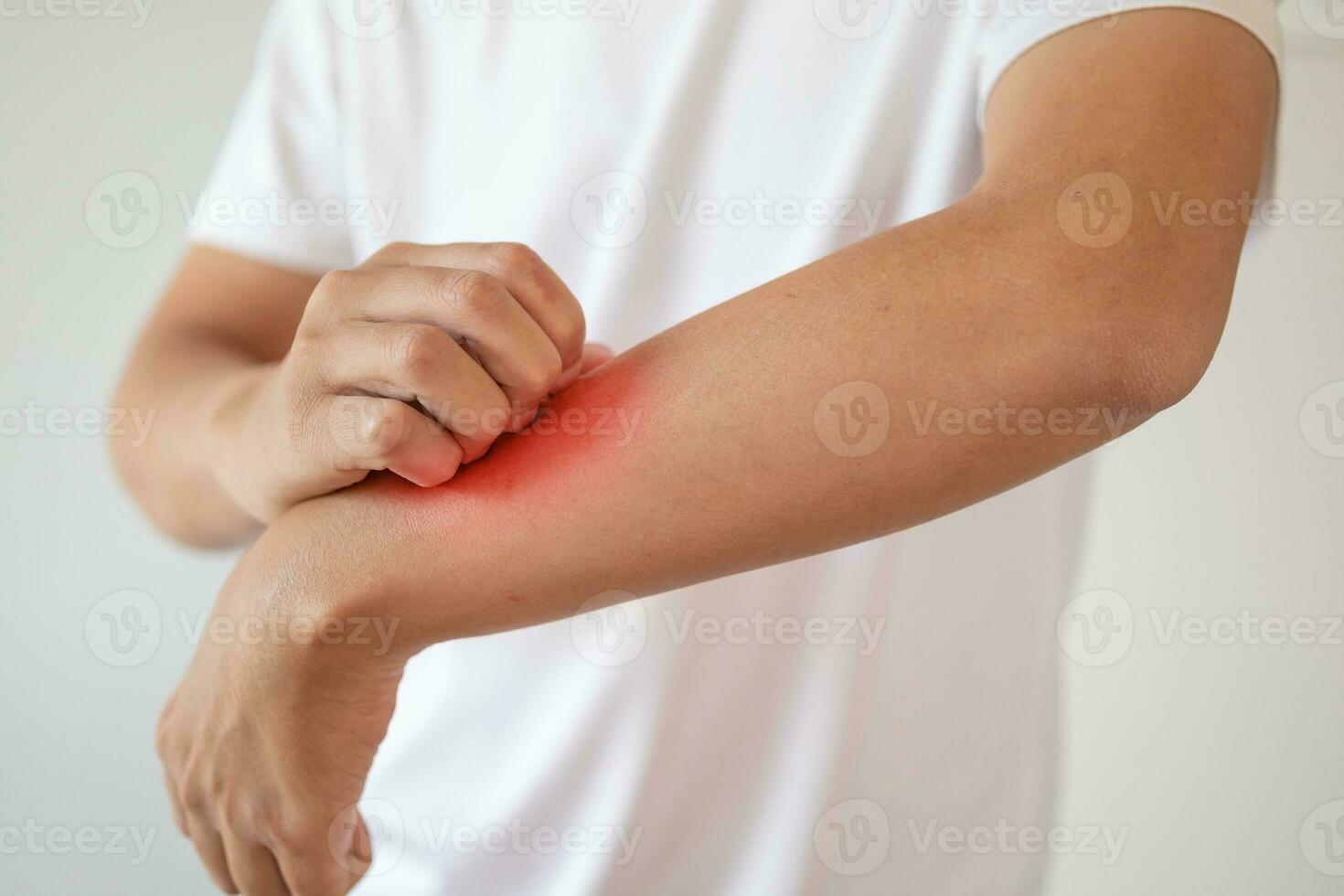 man itching and scratching on arm from itchy dry skin eczema dermatitis photo