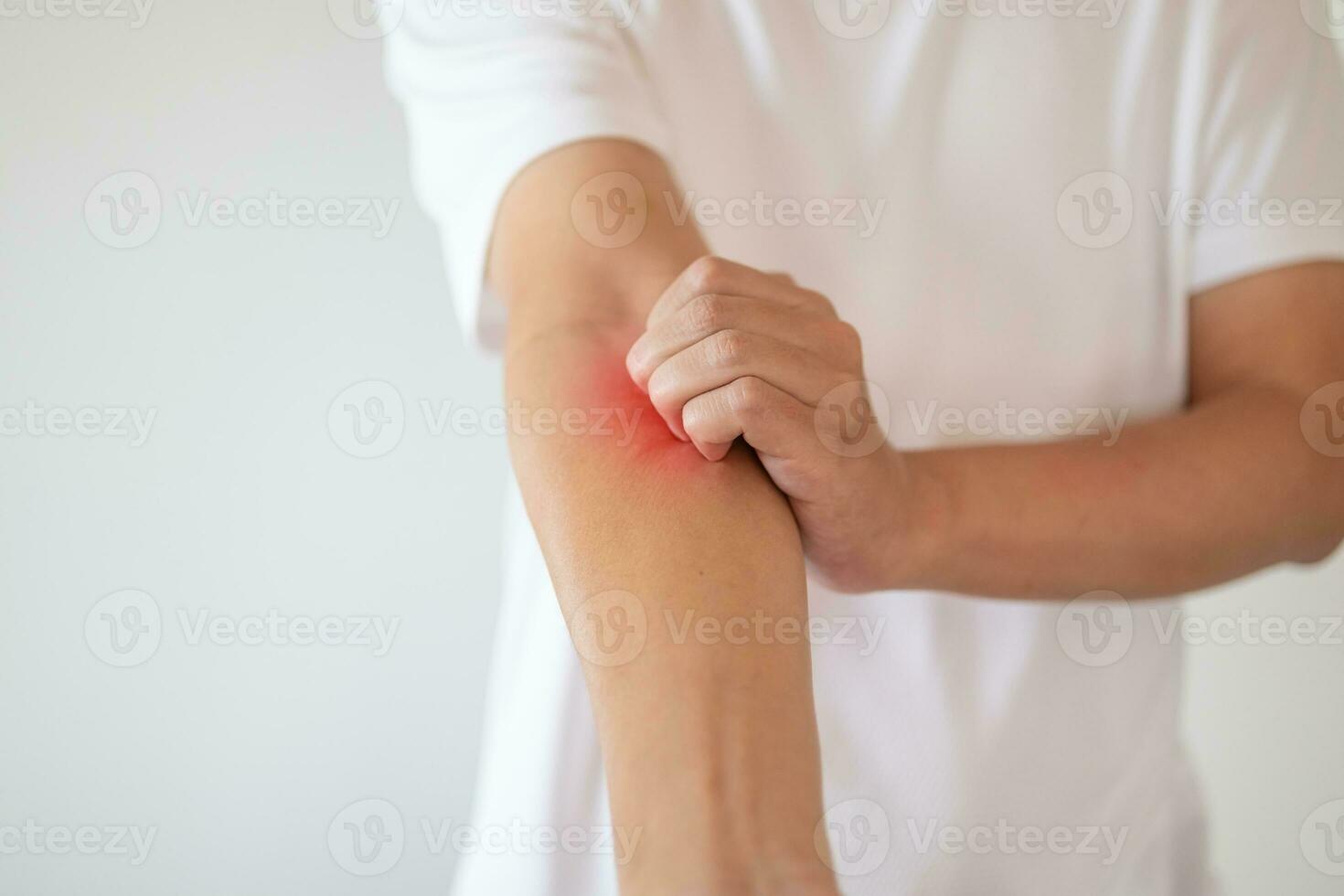 hombre picazón y rascado en el brazo por picazón en la piel seca eczema dermatitis foto