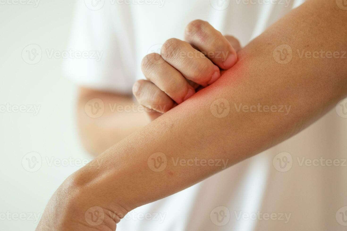 man itching and scratching on arm from itchy dry skin eczema dermatitis photo