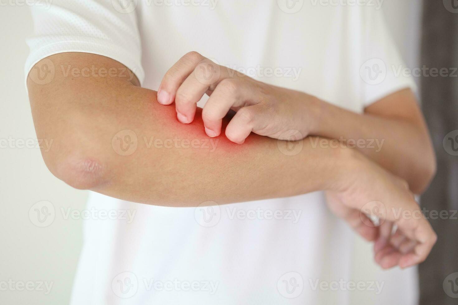 man itching and scratching on arm from itchy dry skin eczema dermatitis photo