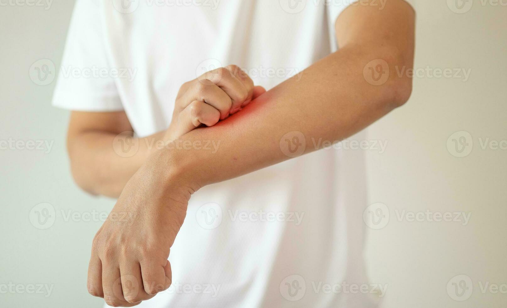 man itching and scratching on arm from itchy dry skin eczema dermatitis photo