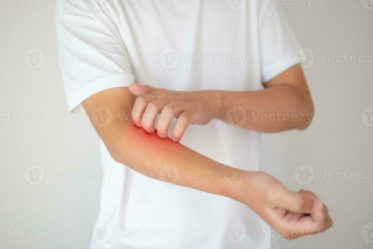 man itching and scratching on arm from itchy dry skin eczema dermatitis photo