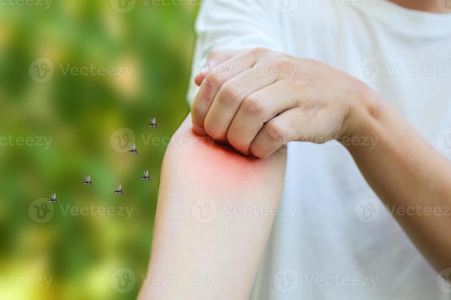 Man itching and scratching on arm from allergy skin rash cause by Mosquitoes bite photo