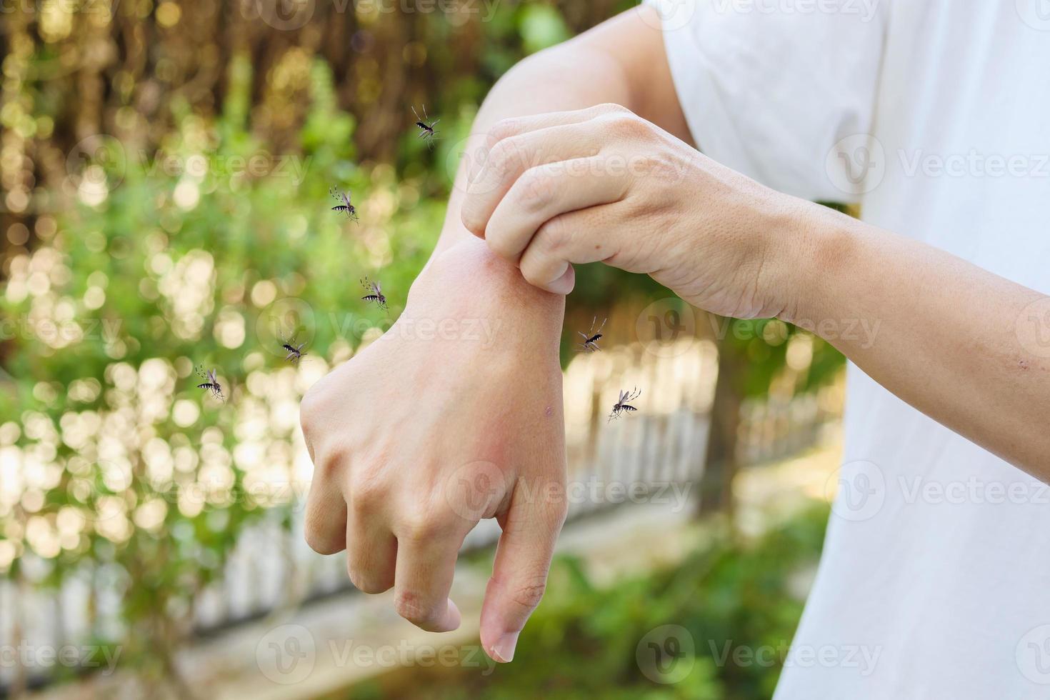 Man itching and scratching on arm from allergy skin rash cause by Mosquitoes bite photo
