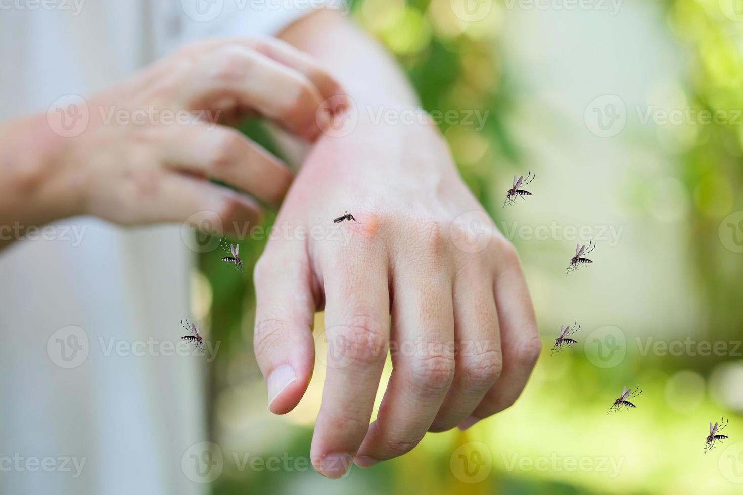 Man itching and scratching on hand from allergy skin rash cause by Mosquitoes bite photo