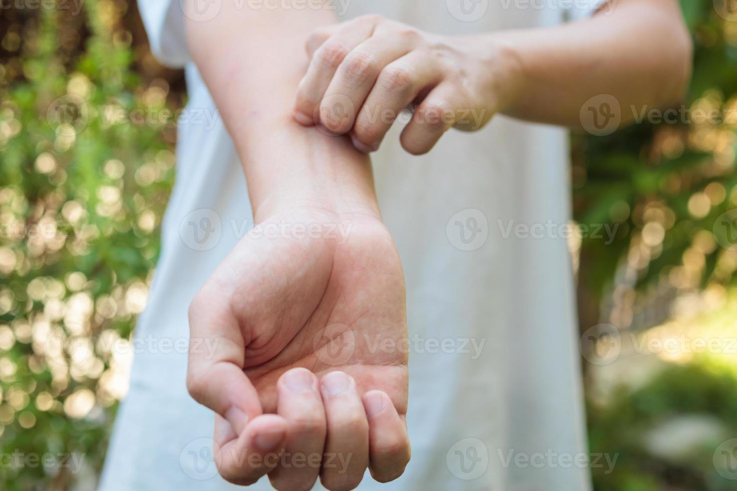 Man itching and scratching on arm from allergy skin rash cause by insect bite outdoor photo