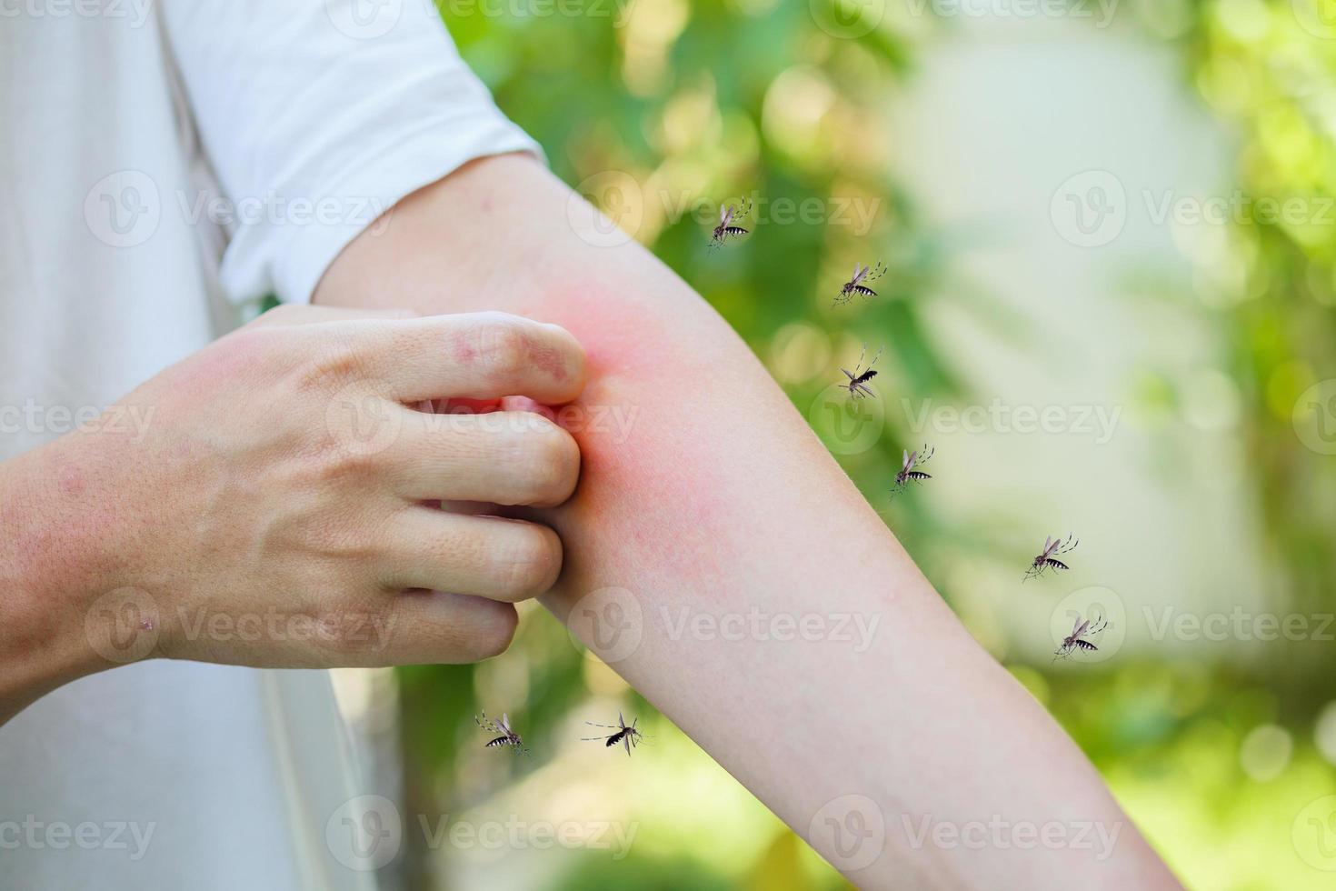 Man itching and scratching on arm from allergy skin rash cause by Mosquitoes bite photo