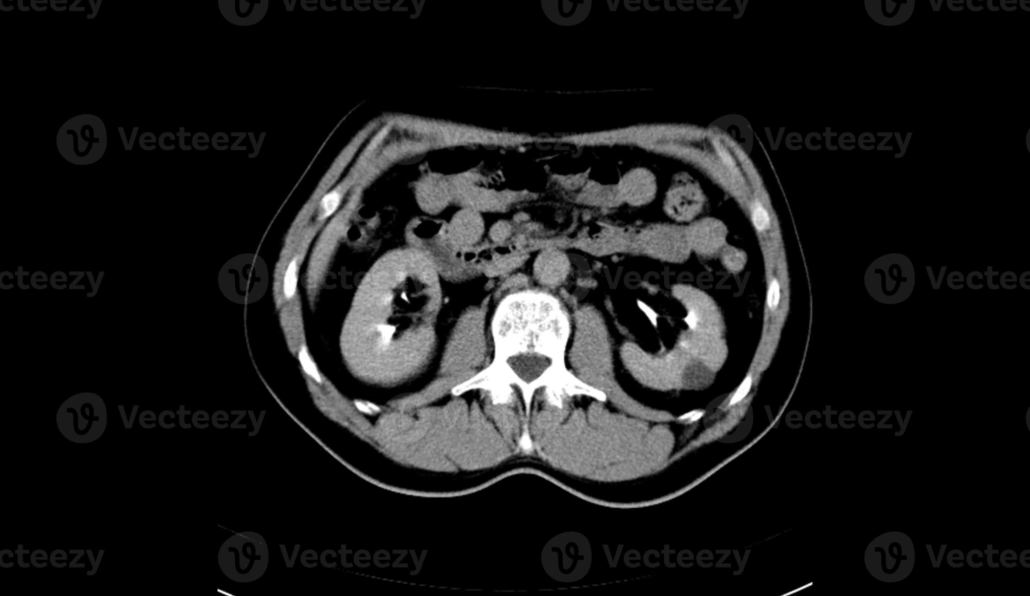 Abdomen human, man, CT scan 12871211 Stock Photo at Vecteezy Biology Diagrams