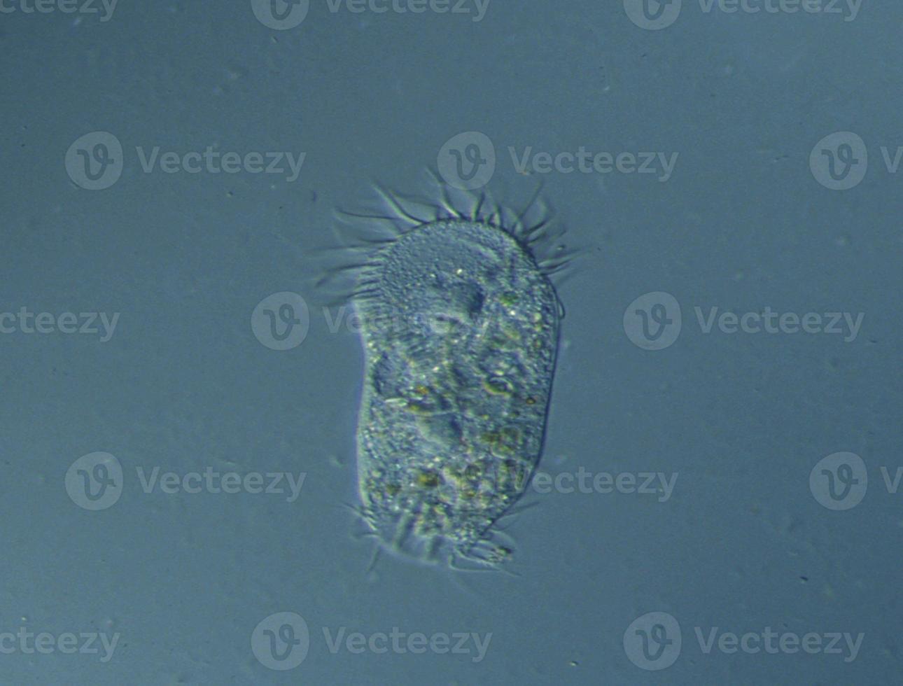 ciliates under microscope