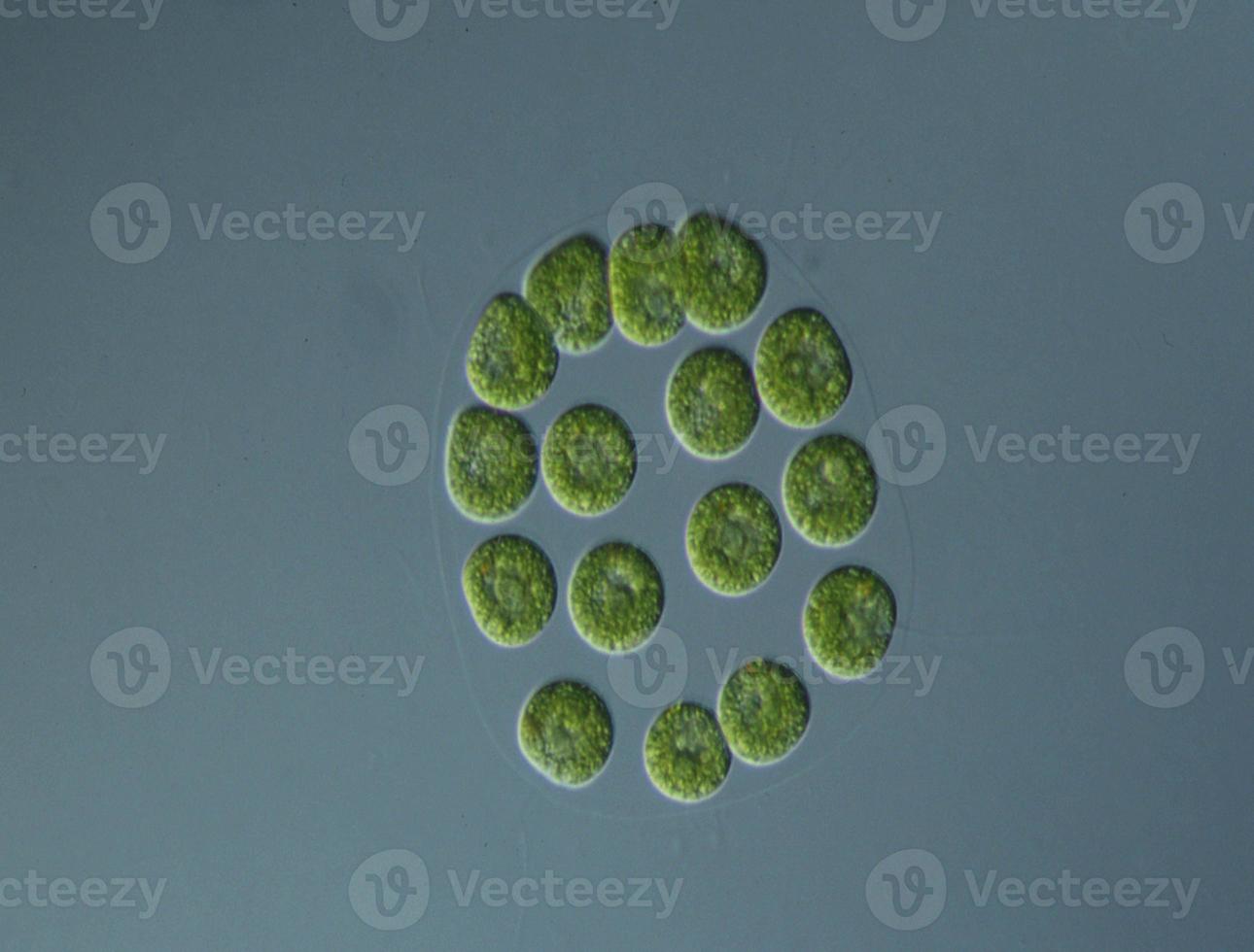 Green algae at high magnification under the microscope 12871402 Stock