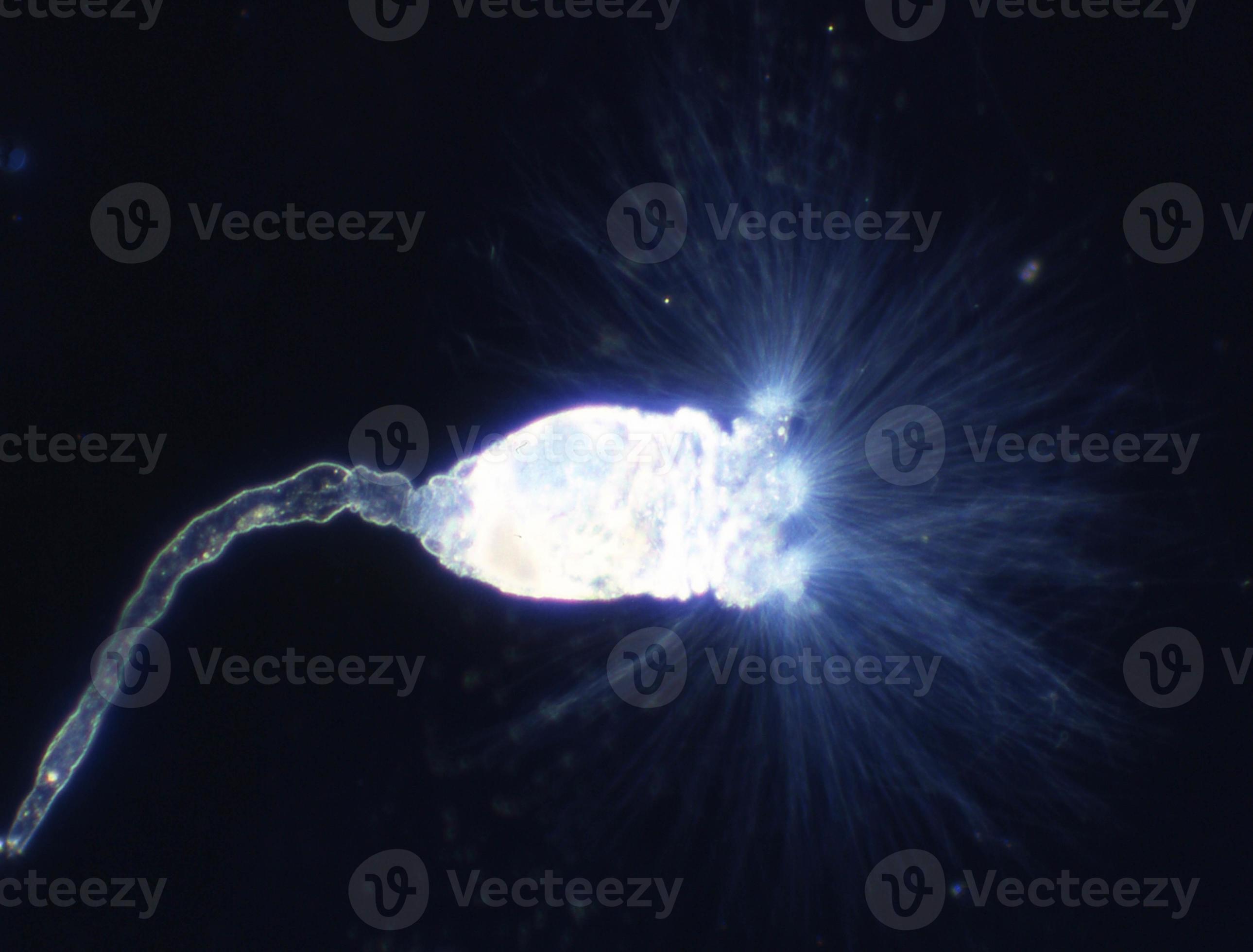 Unseen Battle: Amoebas Feast On Algae, Impacting Water Quality - exmophr