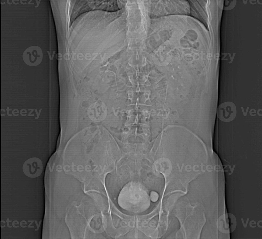 Abdomen human man CT scan 12871898 Stock Photo at Vecteezy Biology Diagrams