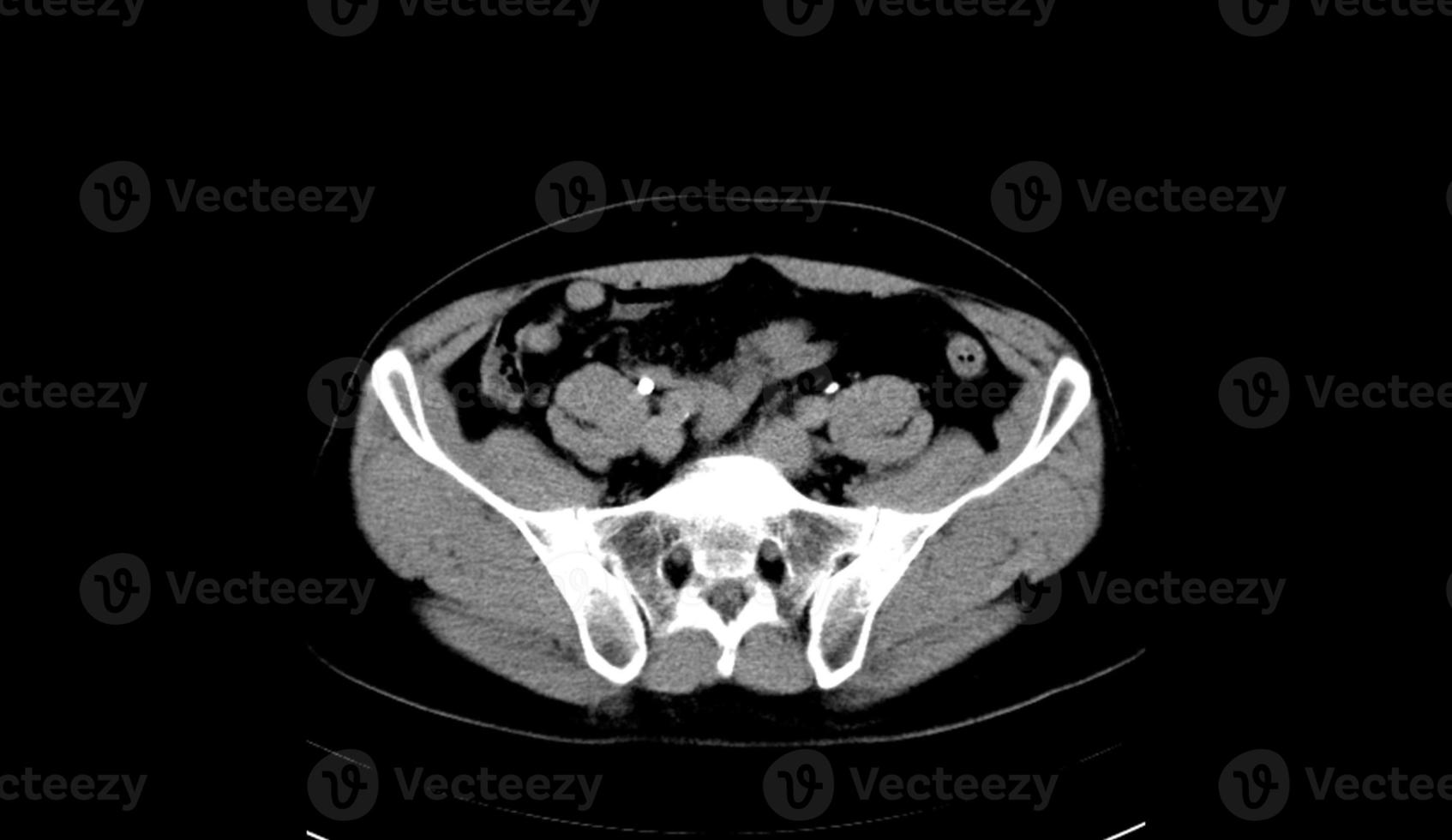 Abdomen human, man, CT scan 12872427 Stock Photo at Vecteezy Biology Diagrams
