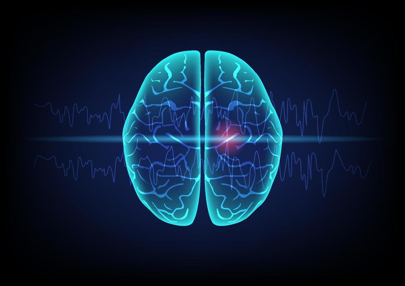 Illustration of human brain and brain wave on technology background. Concept of focal seizure. vector