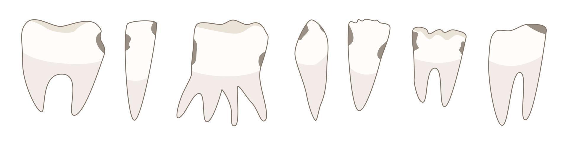 Set with damaged molars. Vector illustration
