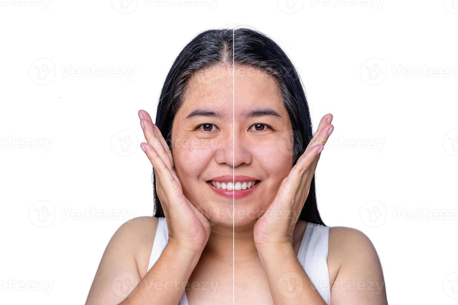 Middle aged mature woman, older 40s year lady before and after skin care retouching and treatment. Female face cut in half present clean perfect skin from wrinkles and acne problems, skin care concept photo