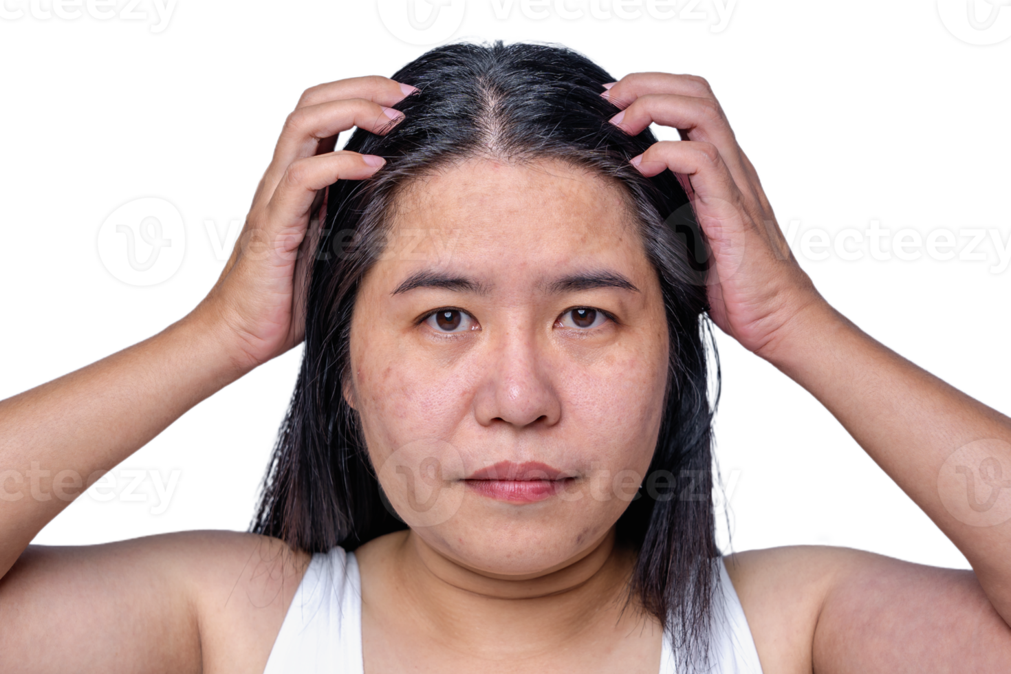 Asian adult woman face has freckles, large pores, blackhead pimple and scars problem from not take care for a long time. Skin problem face isolated white background. Treatment and Skincare concept png