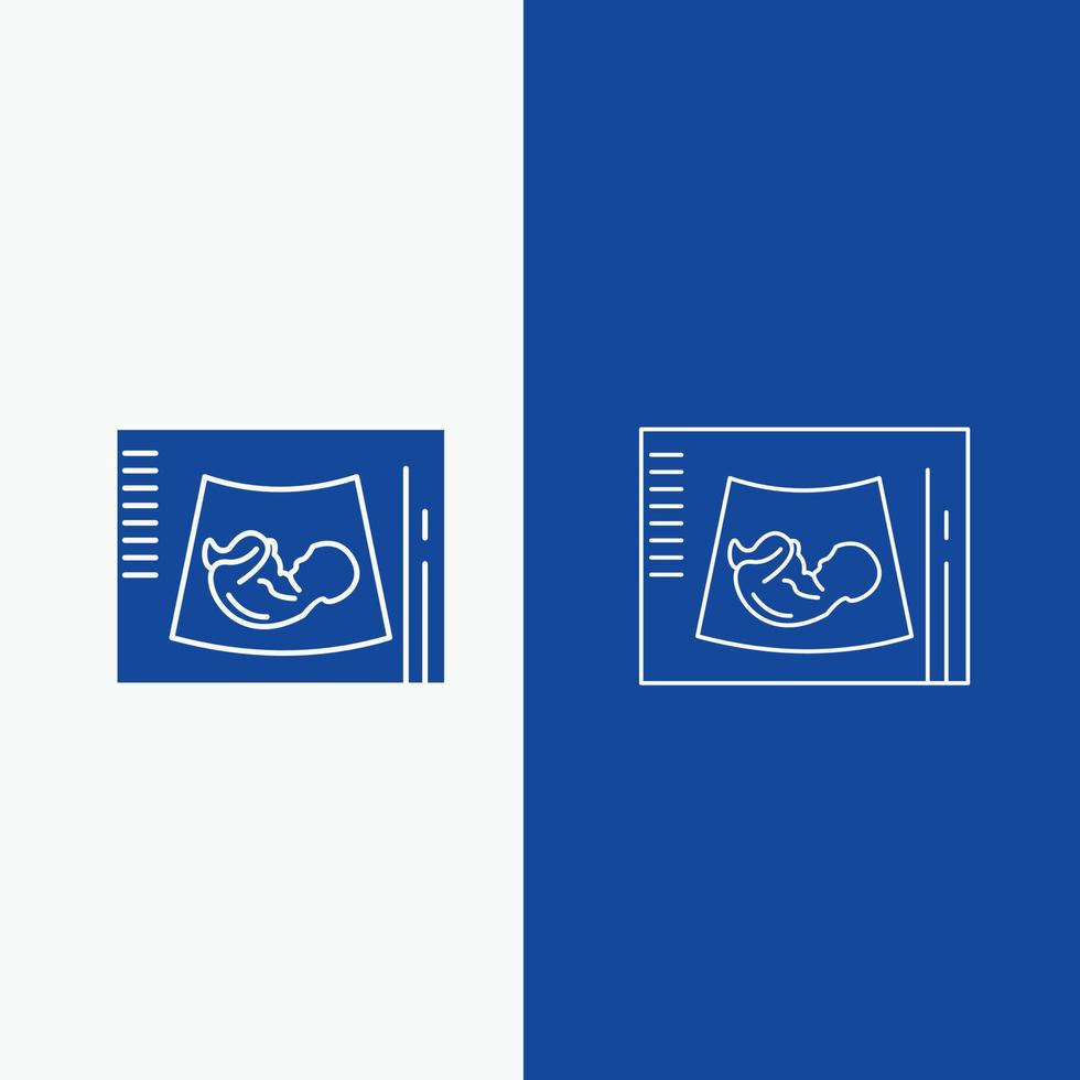 maternidad. el embarazo. sonograma bebé. línea de ultrasonido y botón web de glifo en banner vertical de color azul para ui y ux. sitio web o aplicación móvil vector