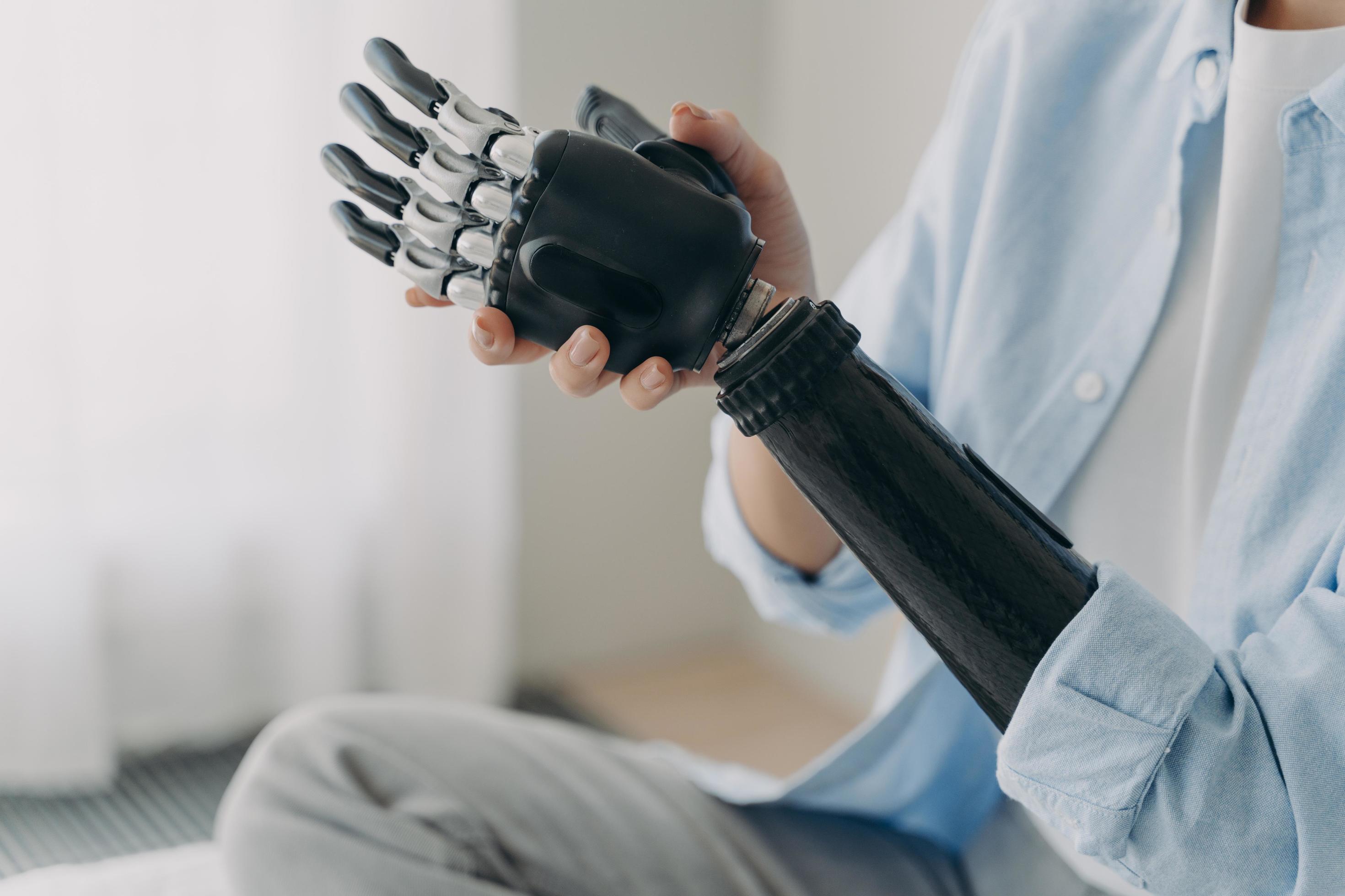 Person with disability puts together bionic prosthetic arm. Ad of high ...