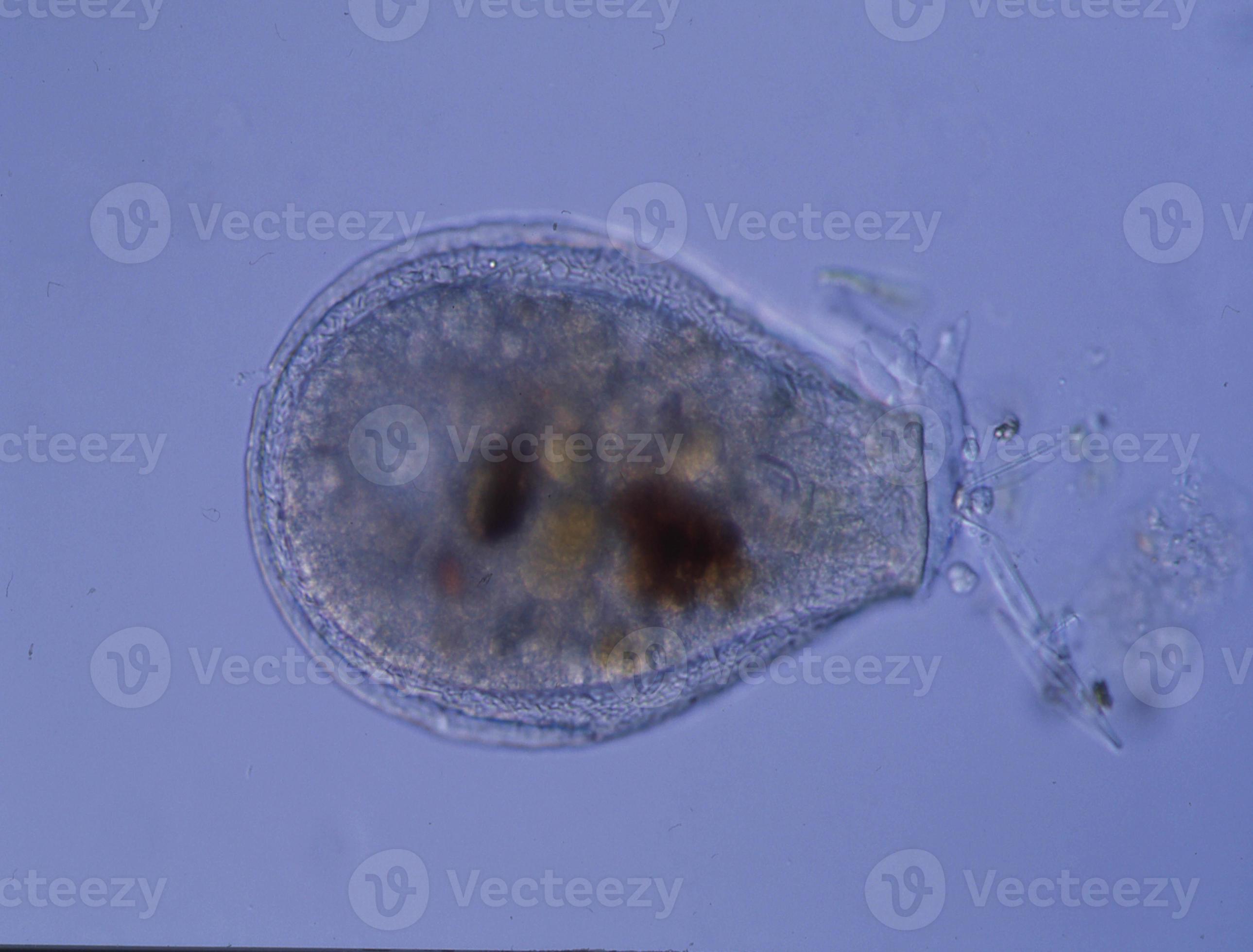Amoeba with false feet under the microscope 100x 12968912 Stock Photo