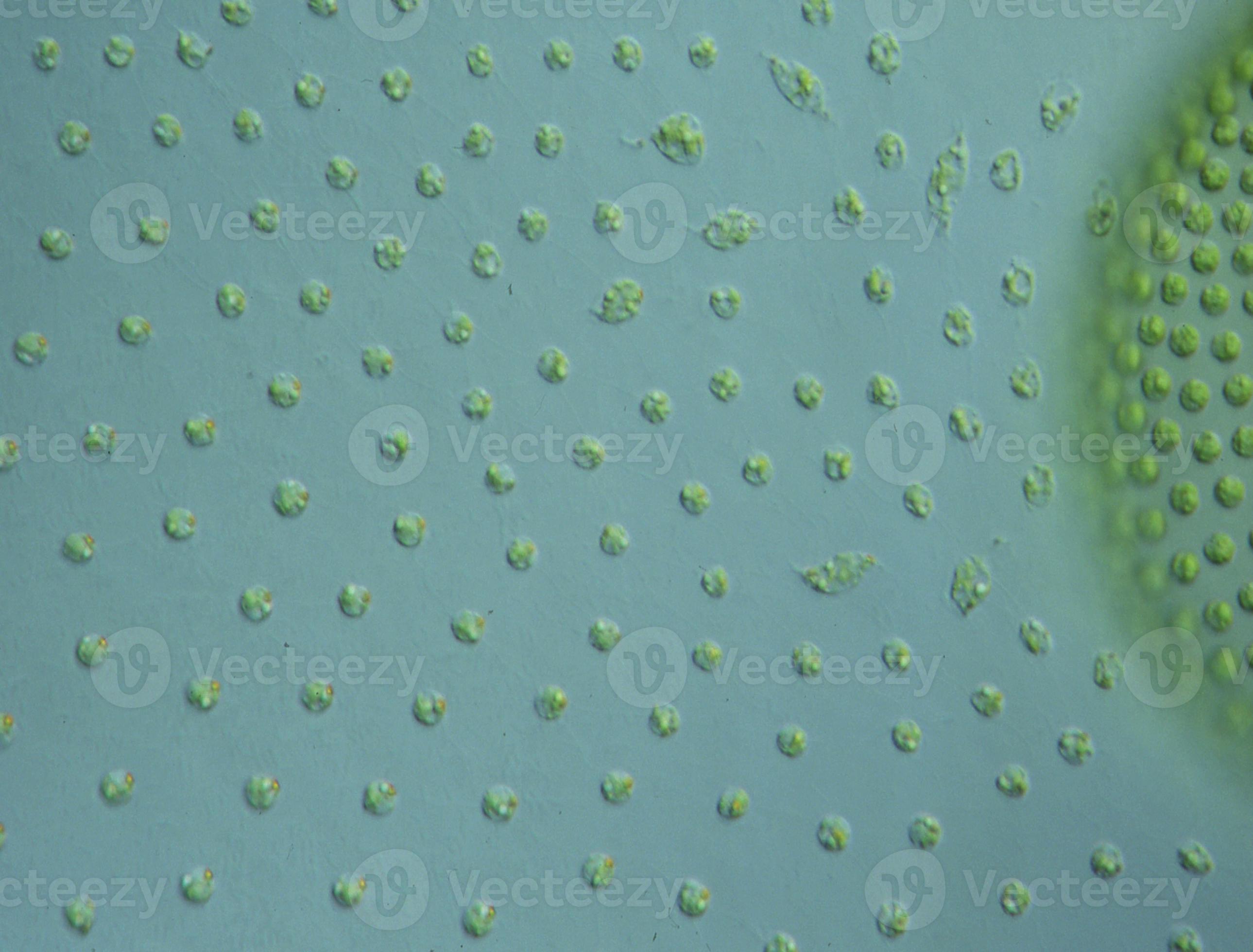 Green algae in drops of water under the microscope 100x 12971051 Stock