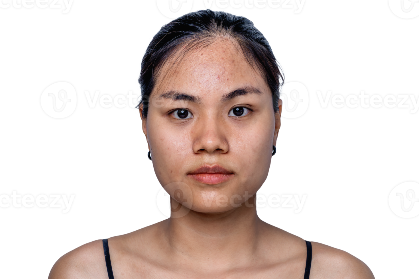 la giovane donna asiatica si preoccupa per il suo viso quando ha problemi con la pelle del viso in uno sfondo naturale. problemi con acne e cicatrici sulla pelle femminile. problema di cura della pelle e concetto di salute. png