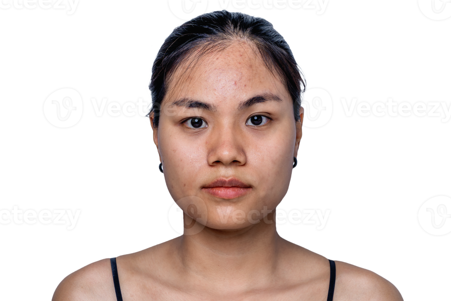 Young Asian woman worry about her face when she has problems with skin on her face in a natural background. Problems with acne and scar on the female skin. Problem skincare and health concept. png