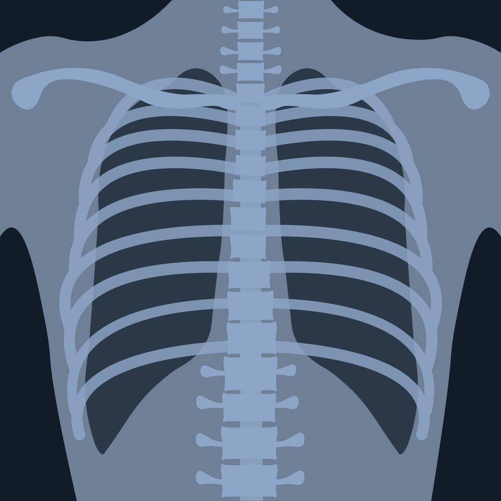 radiografía de tórax en posición vertical para la investigación médica y la docencia vector