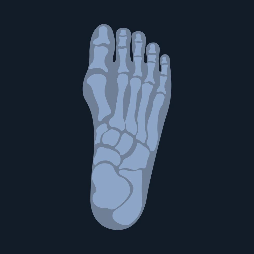 Upper radiograph of a human foot or limb. X-ray or radiographic image of the bones of the metatarsus and toes, viewed from above. Medical Radiology vector