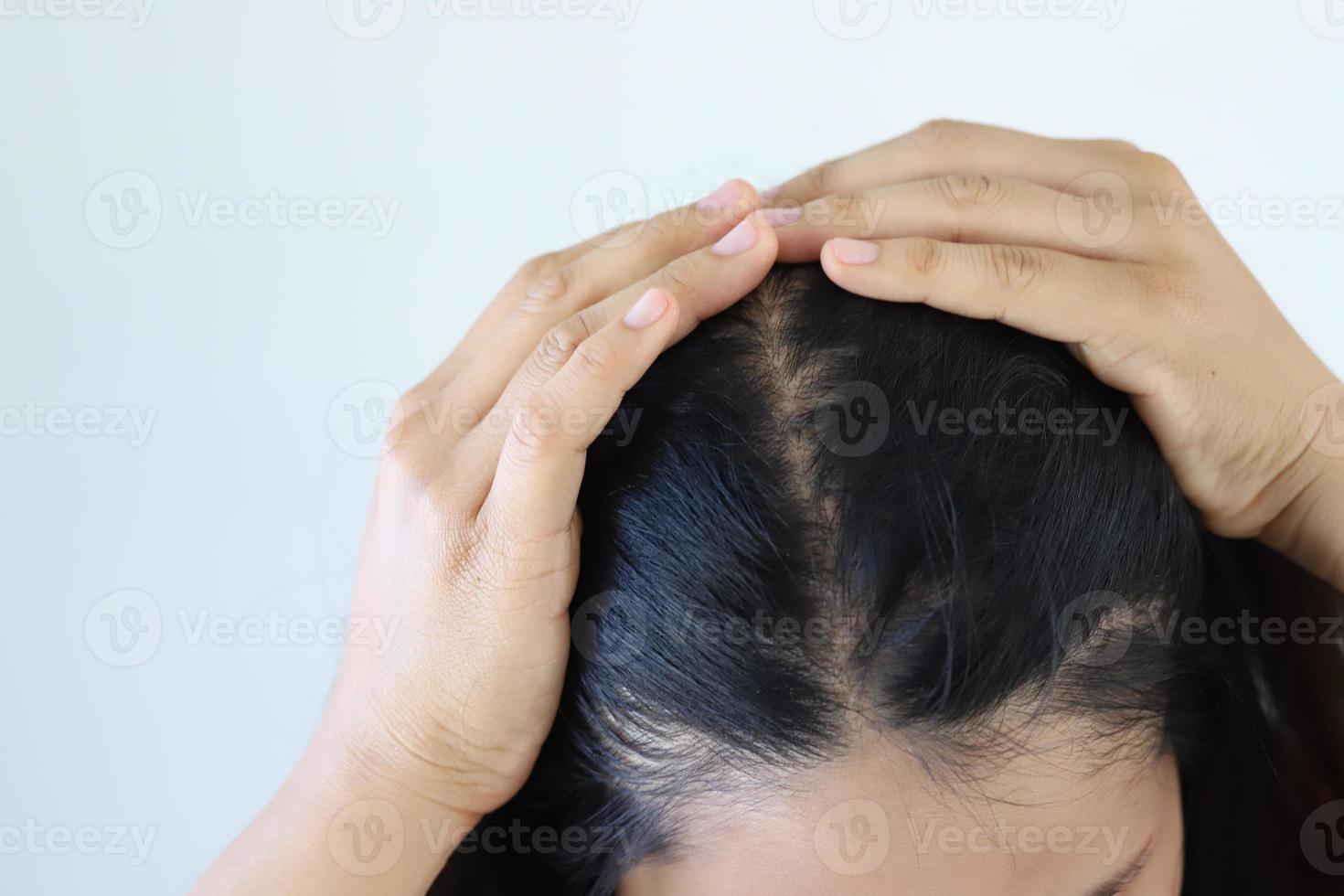 Hair loss in the brush of the woman photo