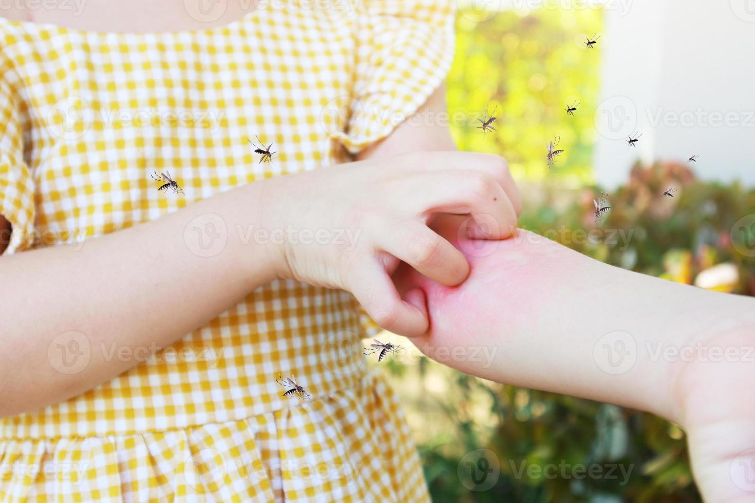 Little girl has skin rash allergy and itchy on her arm from mosquito bite photo