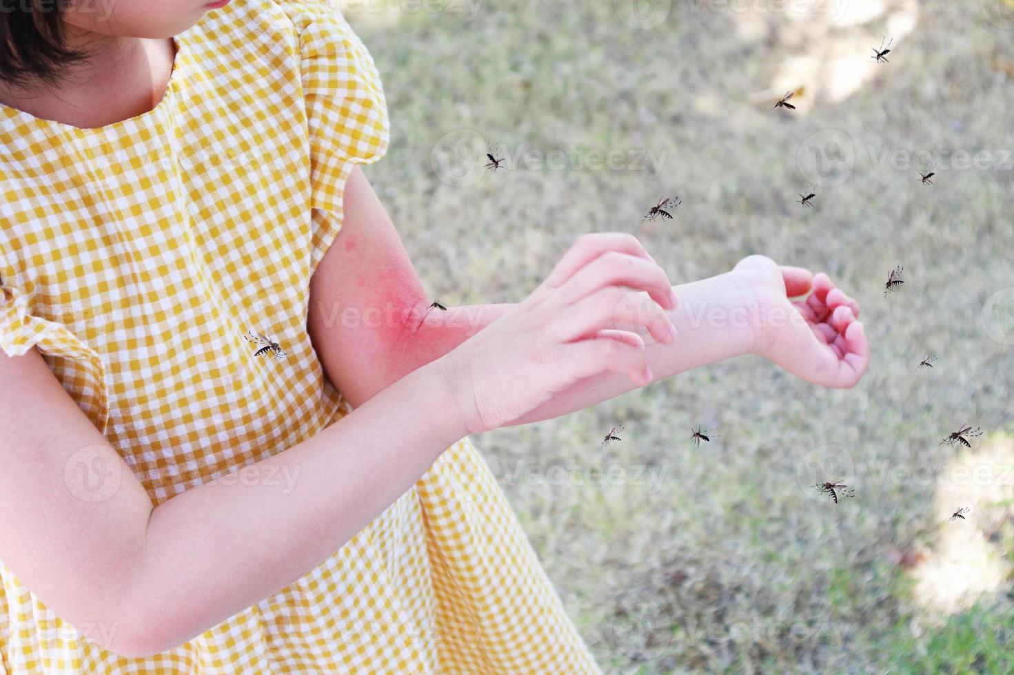Little girl has skin rash allergy and itchy on her arm from mosquito bite photo