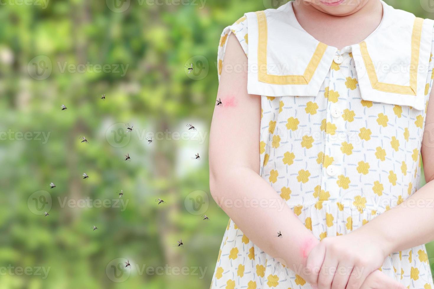 Little girl has skin rash allergy itching and scratching on her arm with mosquitoes bite photo