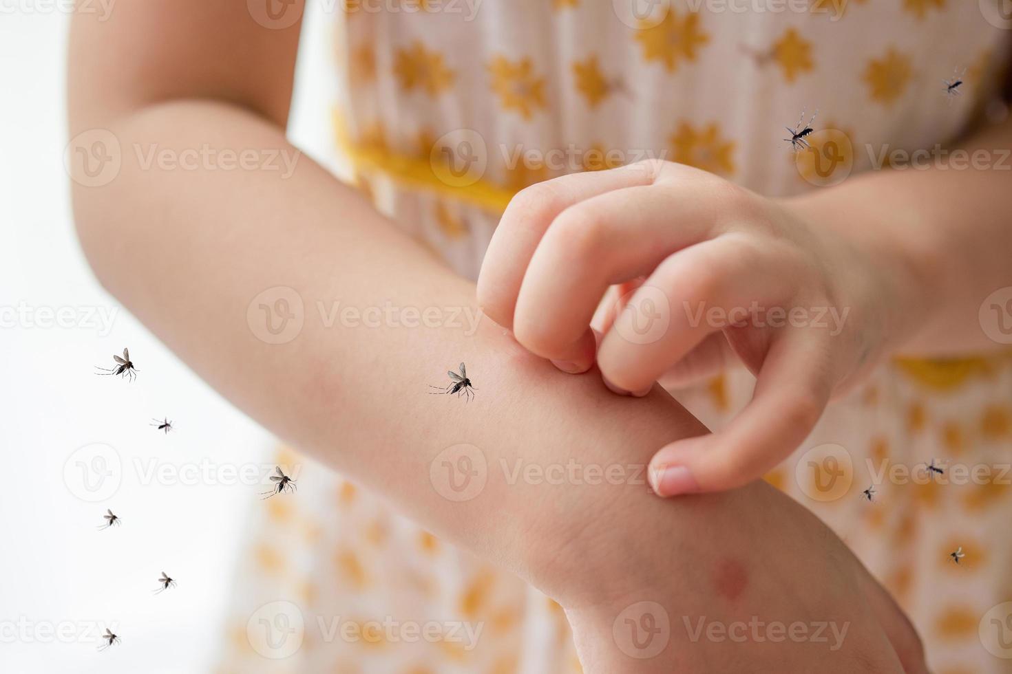 Little girl has skin rash allergy and itchy on her arm from mosquito bite photo