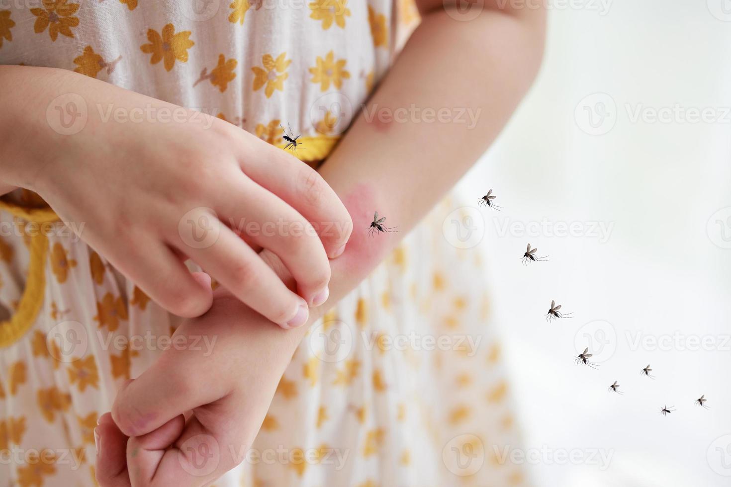 Little girl has skin rash allergy and itchy on her arm from mosquito bite photo