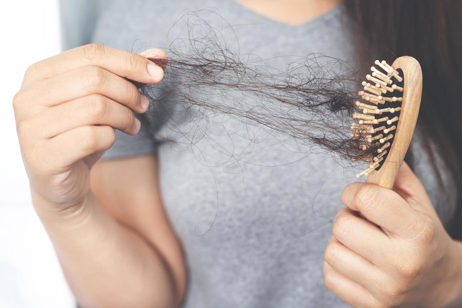 las mujeres tienen problemas de pérdida de cabello. foto