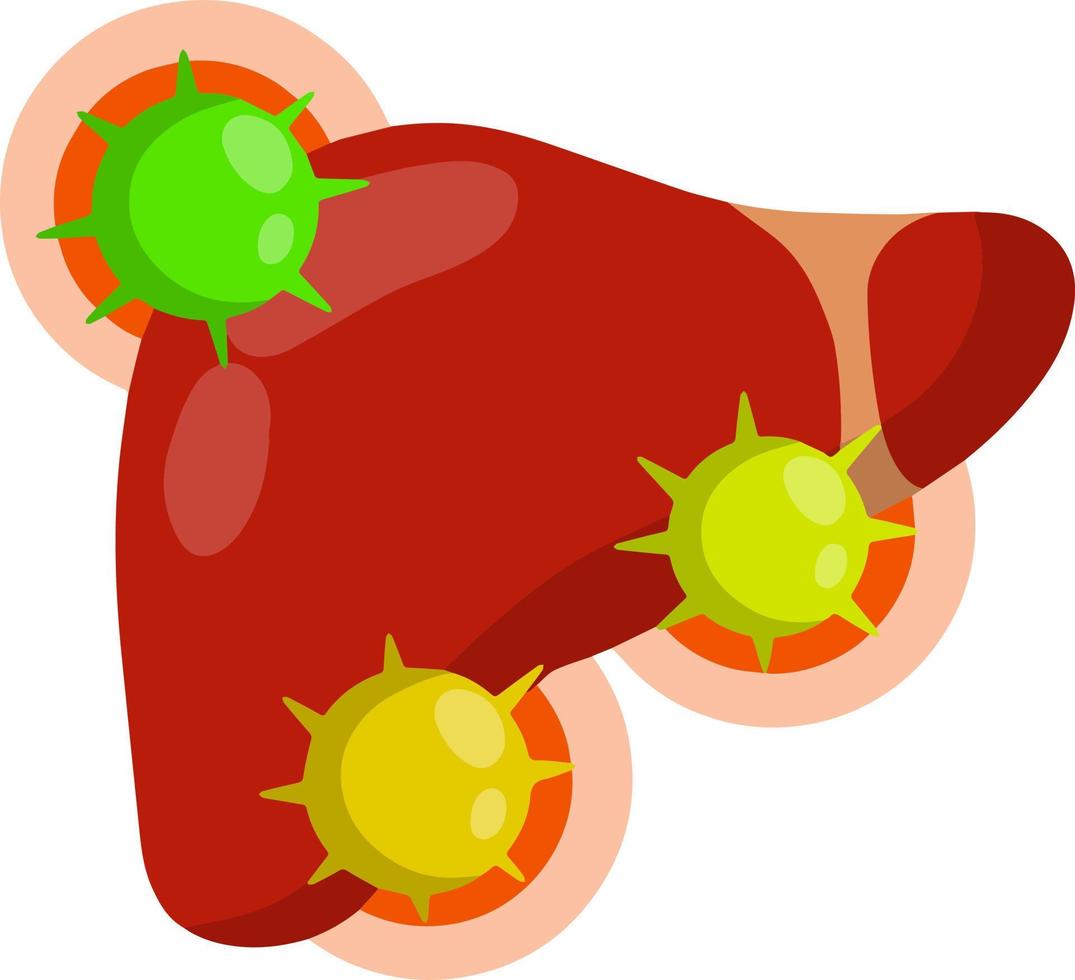 Bad liver. Attack germs and cirrhosis of the liver. Health problem vector