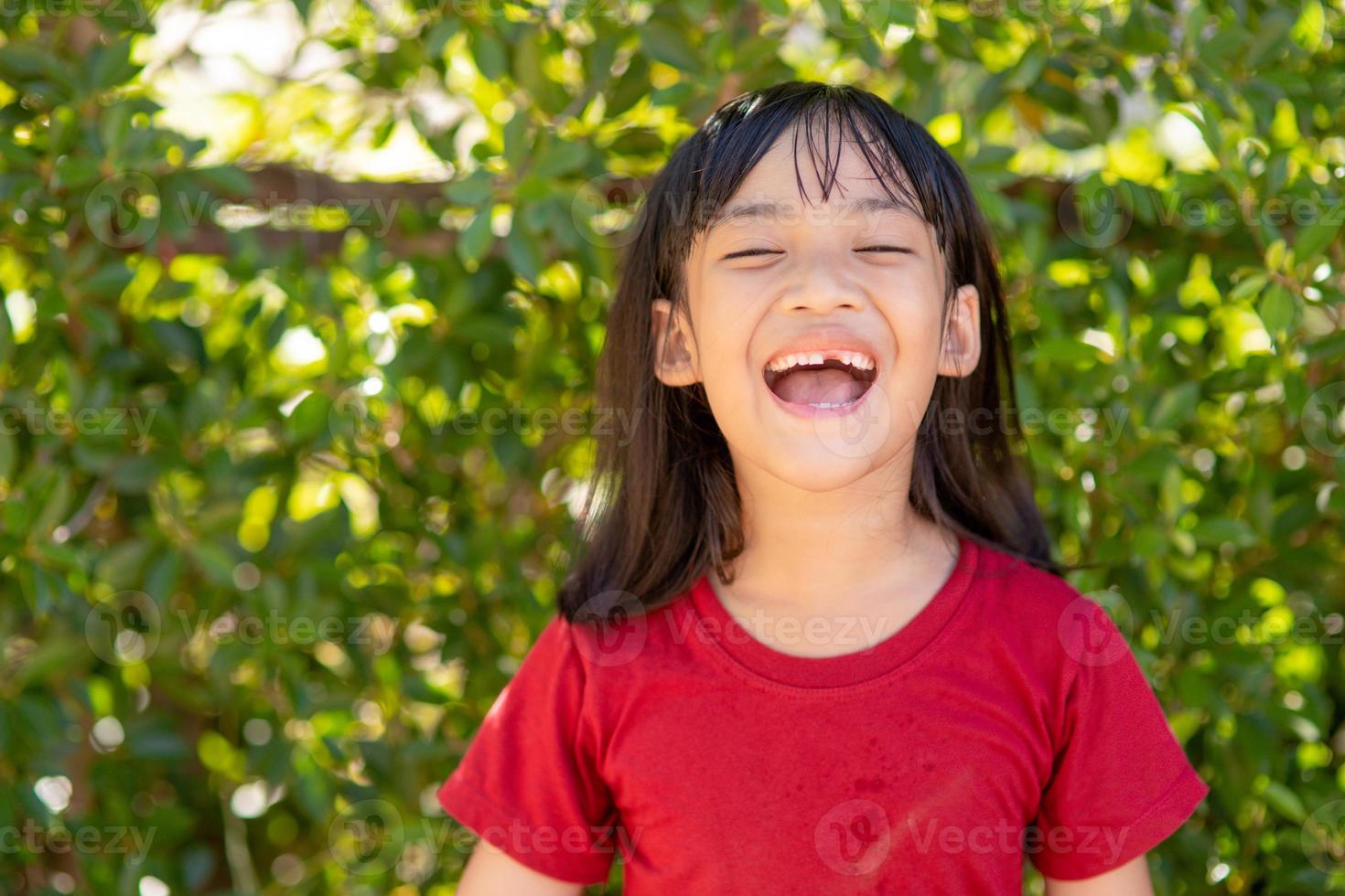 little girl showing her broken milk teeth photo