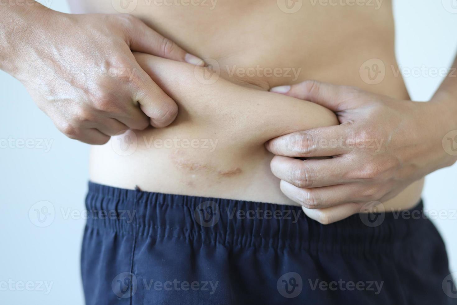 Fat man want to lose weight and control food photo