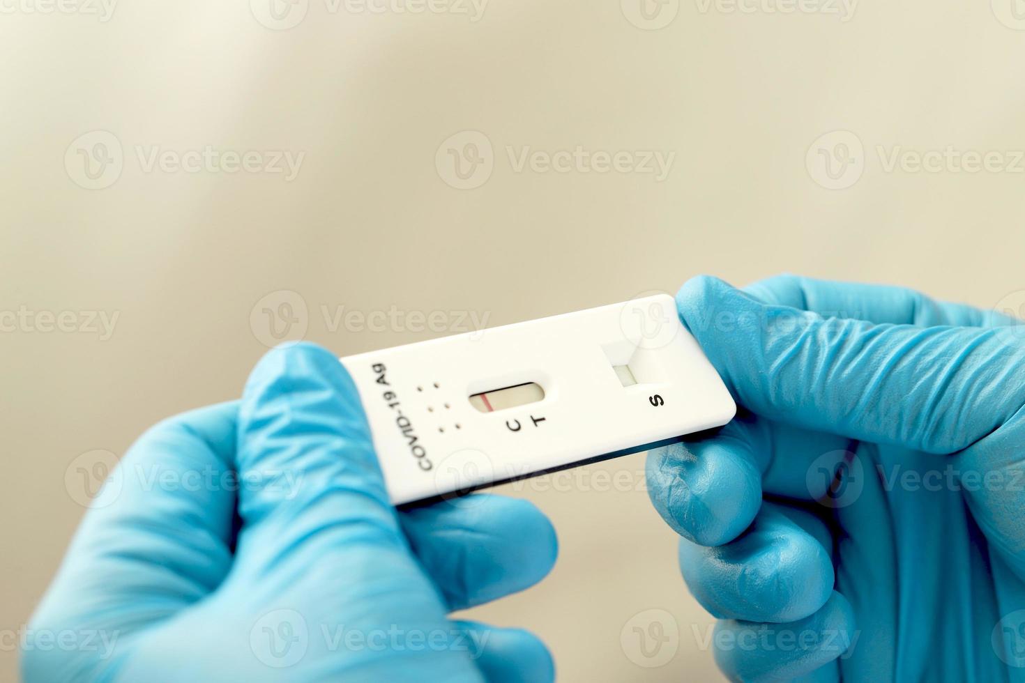 Negative results using rapid test for COVID-19, the novel coronavirus 2019. photo